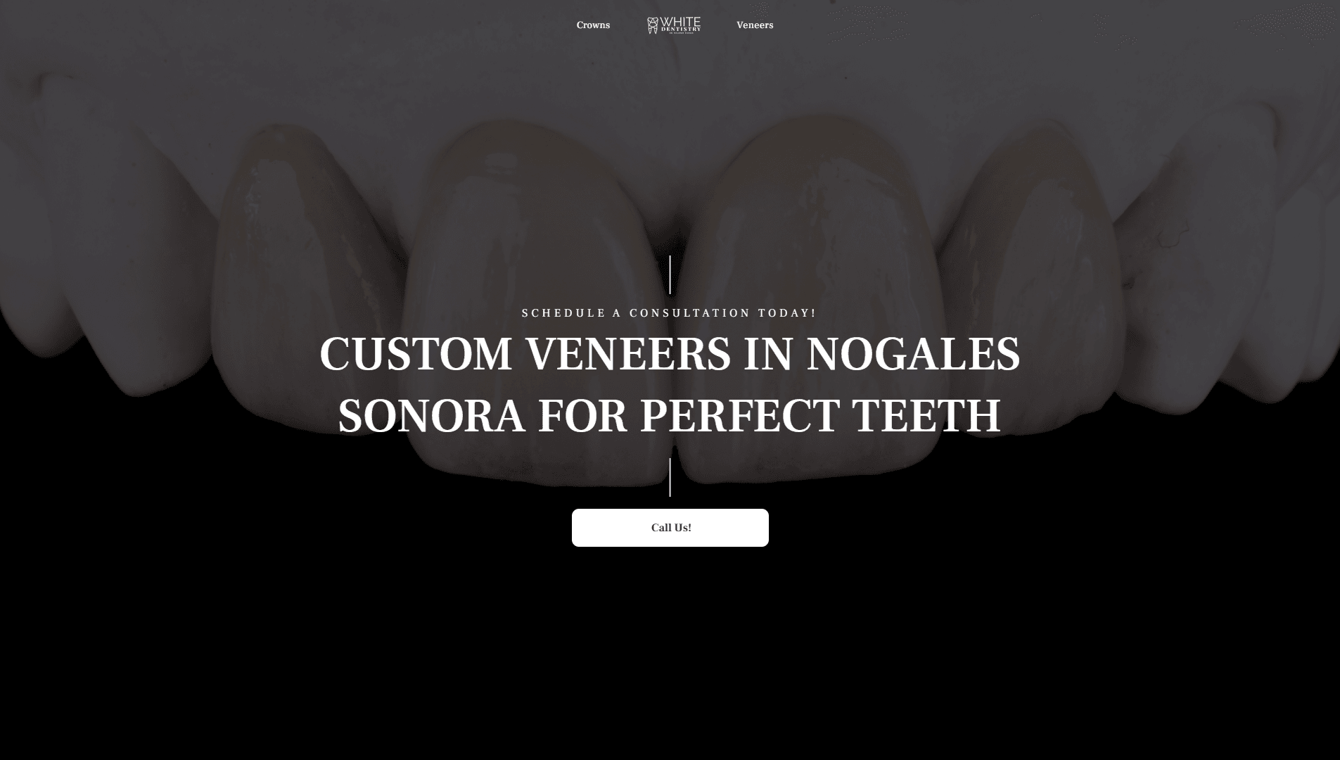 White Dentistry: Captación de pacientes internacionales para carillas